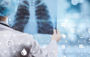 Міфи про туберкульоз: поради, які допоможуть залишатися здоровими