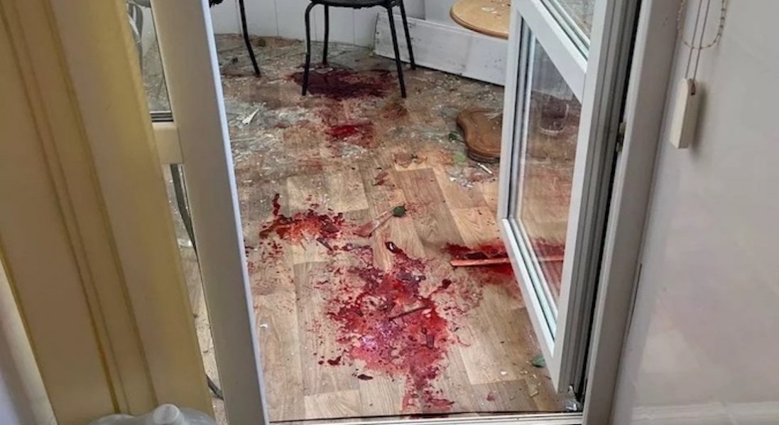 У Херсоні окупанти влучили в лікарню: загинув лікар, поранена медсестра