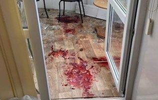 У Херсоні окупанти влучили в лікарню: загинув лікар, поранена медсестра