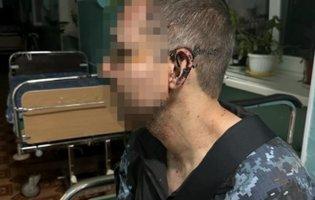 На Одещині у військовій частині побили військового