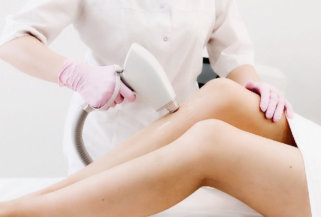 Підготовка до процедури лазерної епіляції