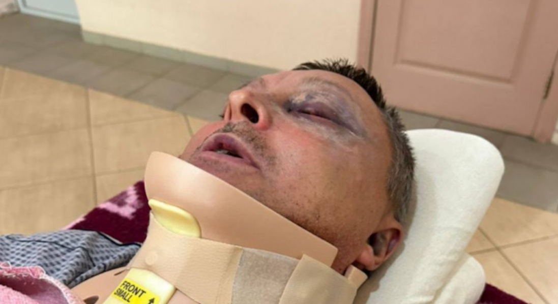 На Одещині напали на військового: має перелом шиї