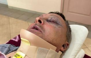 На Одещині напали на військового: має перелом шиї
