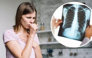 Запалення легень іноді «маскується» під застуду, але призвести може навіть до смерті