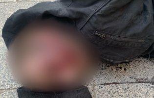 У Львові чоловік з бритвою напав на студентку