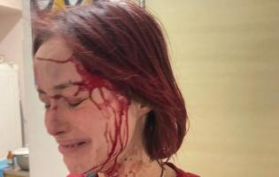 В Одесі чоловік у військовій формі побив дівчину