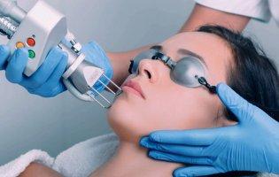 Фракційне лазерне омолодження: Сучасний підхід до збереження молодості