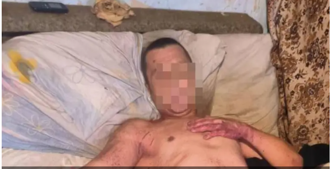 На Закарпатті чоловік вбив співмешканку та відрізав собі статевий орган