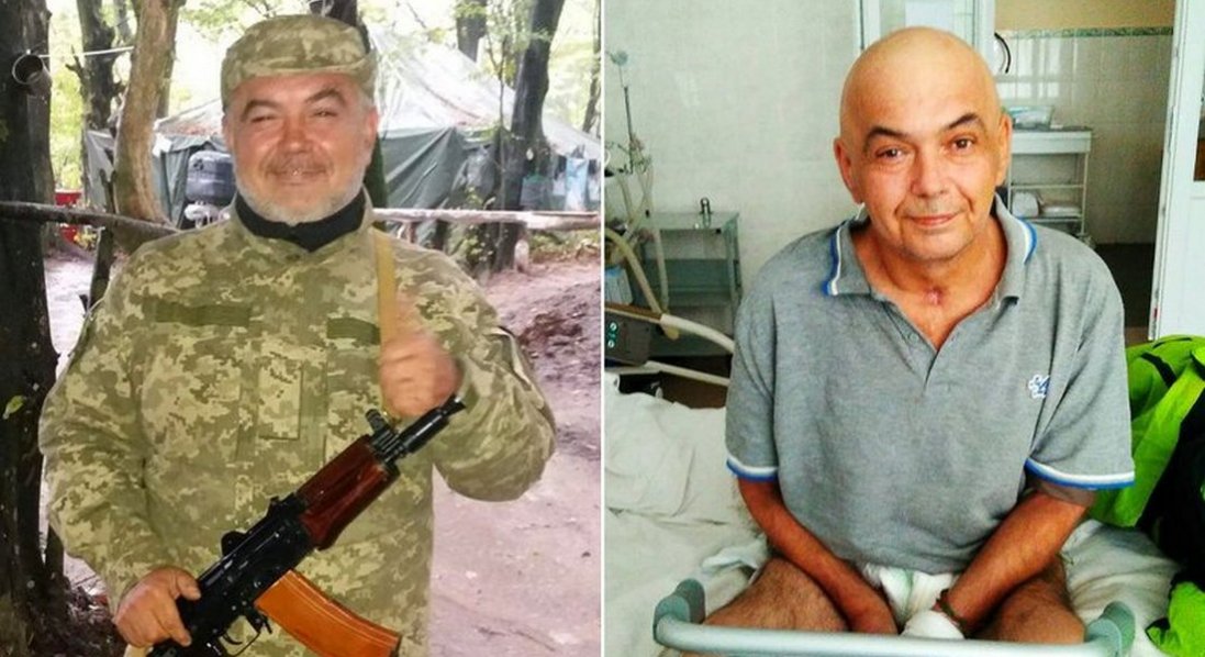 Лікарі давали один відсоток, але він вижив