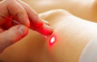 Куди в Києві звернутися для лазерного видалення вен?