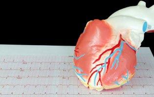 На Волині зросла кількість випадків інфаркту