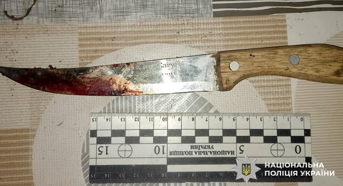 На Рівненщині чоловік відрубав знайомому два пальці