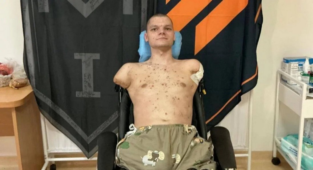 «ПриватБанк» пропонує покрити лікування й протезування ветерану без кінцівок