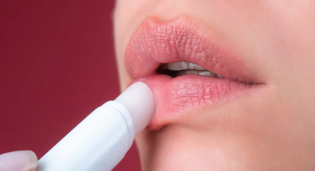 Чому взимку тріскають губи і лущиться шкіра на руках