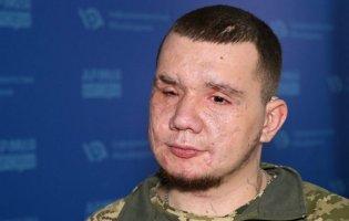 Утратив на фронті зір та слух: такою стала ціна 84 урятованих життів