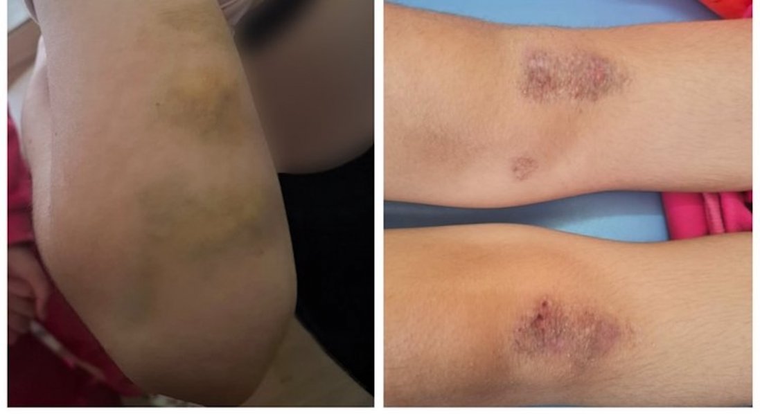 На Полтавщині жінка катувала молодших сестер