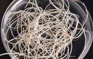 На Волині з чоловіка витягли 15-сантиметрового паразита