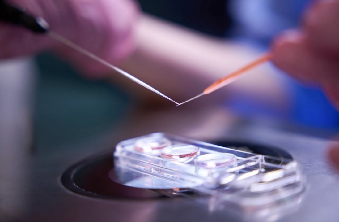 Шлях до омріяного батьківства: як працює сучасне штучне запліднення