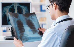 На Волині найменшому пацієнту з пневмонією лише 2 місяці