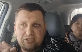 Конфлікт ТЦК та ветерана у Луцьку: версії сторін