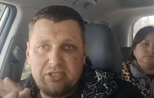 Побиття працівниками ТЦК та СП у Луцьку ветерана війни: справу розглядатимуть у ДБР