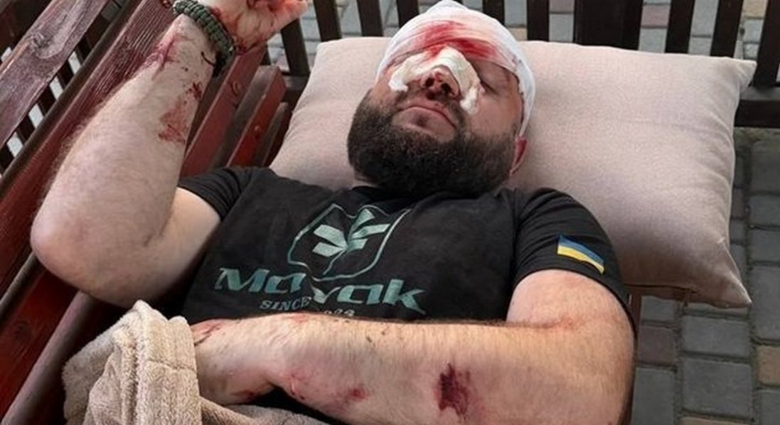 На Одещині арматурою побили військового за зауваження про російську музику