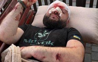 На Одещині арматурою побили військового за зауваження про російську музику