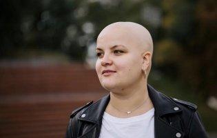 Волосся випадає не лише через вік